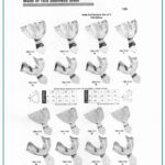 Stainless Steel Impression Trays