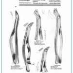 Dental Extracting Forceps for Roots & Molars